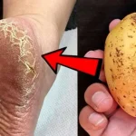 El remedio casero eficaz para acabar con los talones agrietados de forma definitiva