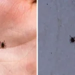 How to get rid of ticks and fleas inside your home and yard